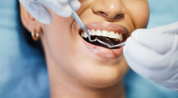 Best Emergency Dental Care for Abscessed Tooth in Kalamazoo, MI